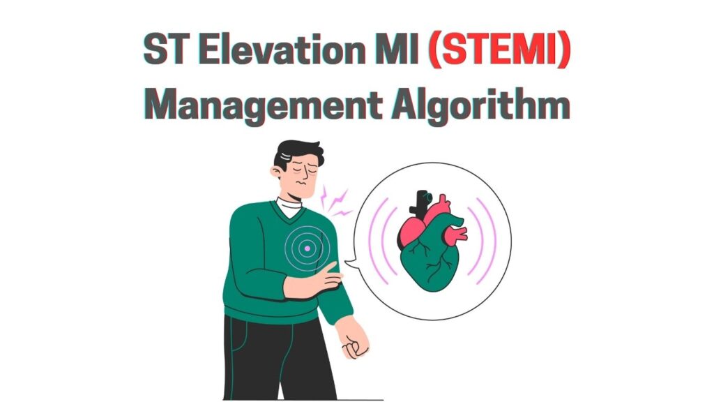 STEMI Management Algorithm