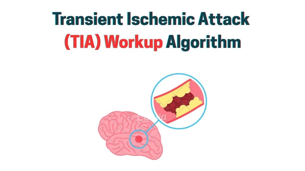 Transient Ischemic Attack (TIA) Workup Algorithm